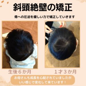 大阪市北区・生後6ヶ月・赤ちゃん頭のゆがみ・赤ちゃん整体